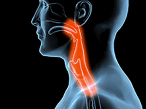 Dysphagia: What Your Speech Language Pathologist Wants You to Know