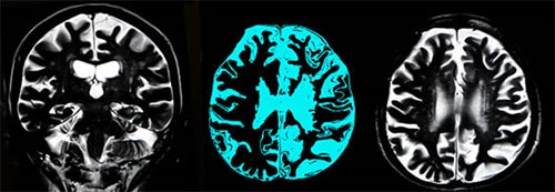 Brain Scan