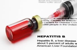 Hepatitis B